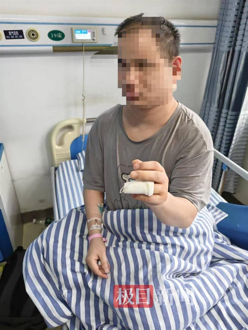 学者：留意带状疱疹高风险人群 预防是第一步